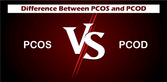 PCOS vs PCOD