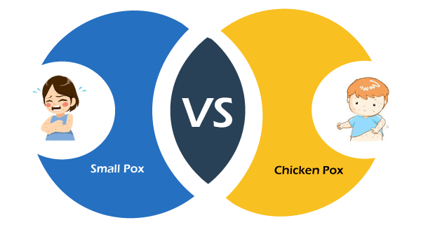 Small Pox vs Chicken Pox
